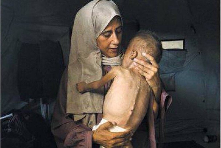 Fausse photo de famine à Gaza : le New York Times se rétracte